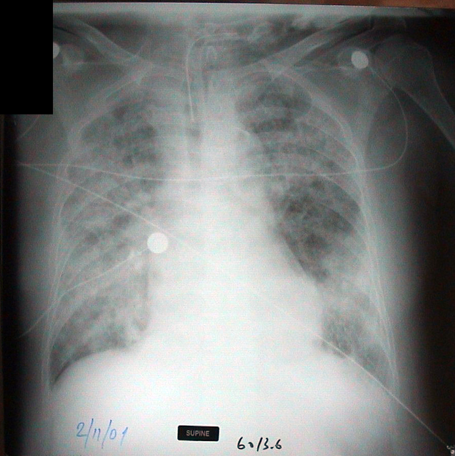 20011102 cxr desktop resolution