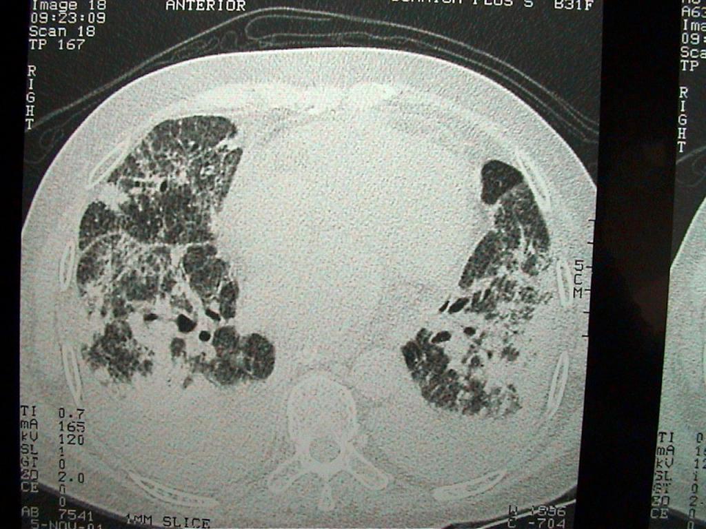 20011105 ct 1 desktop resolution