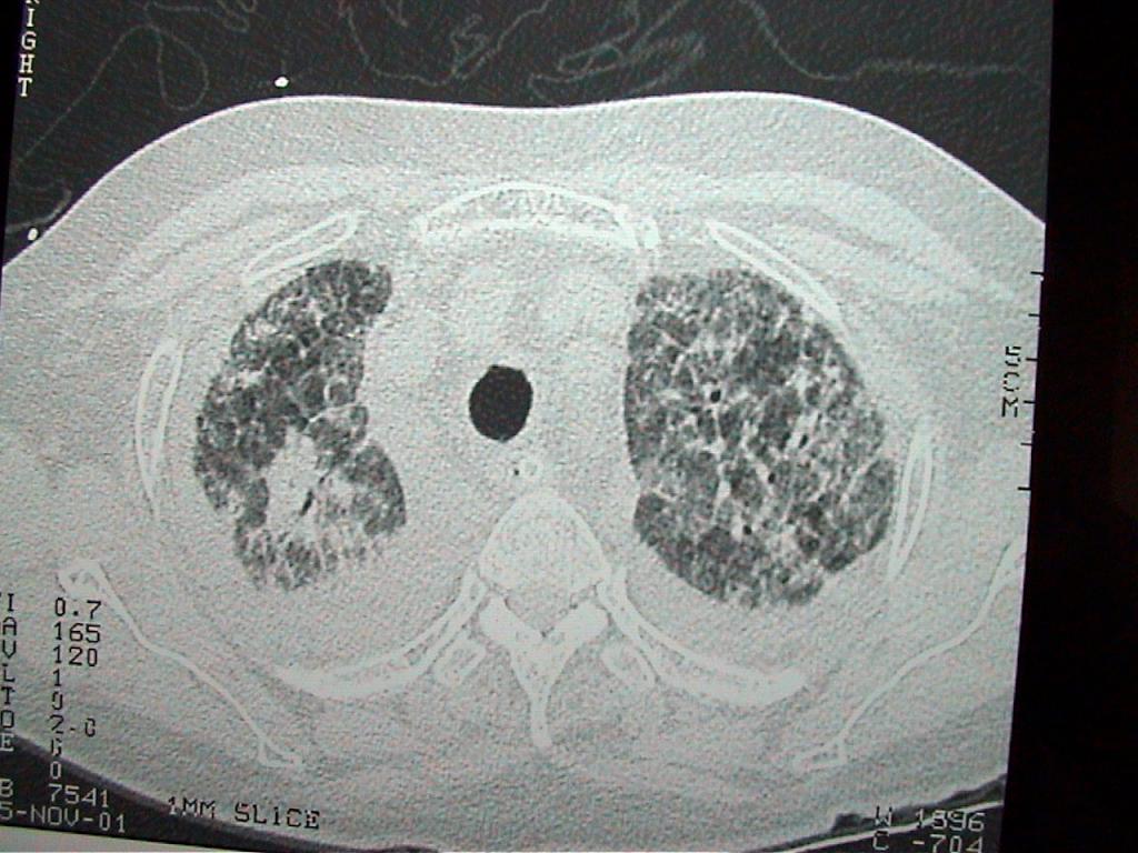 20011105 ct 3 desktop resolution