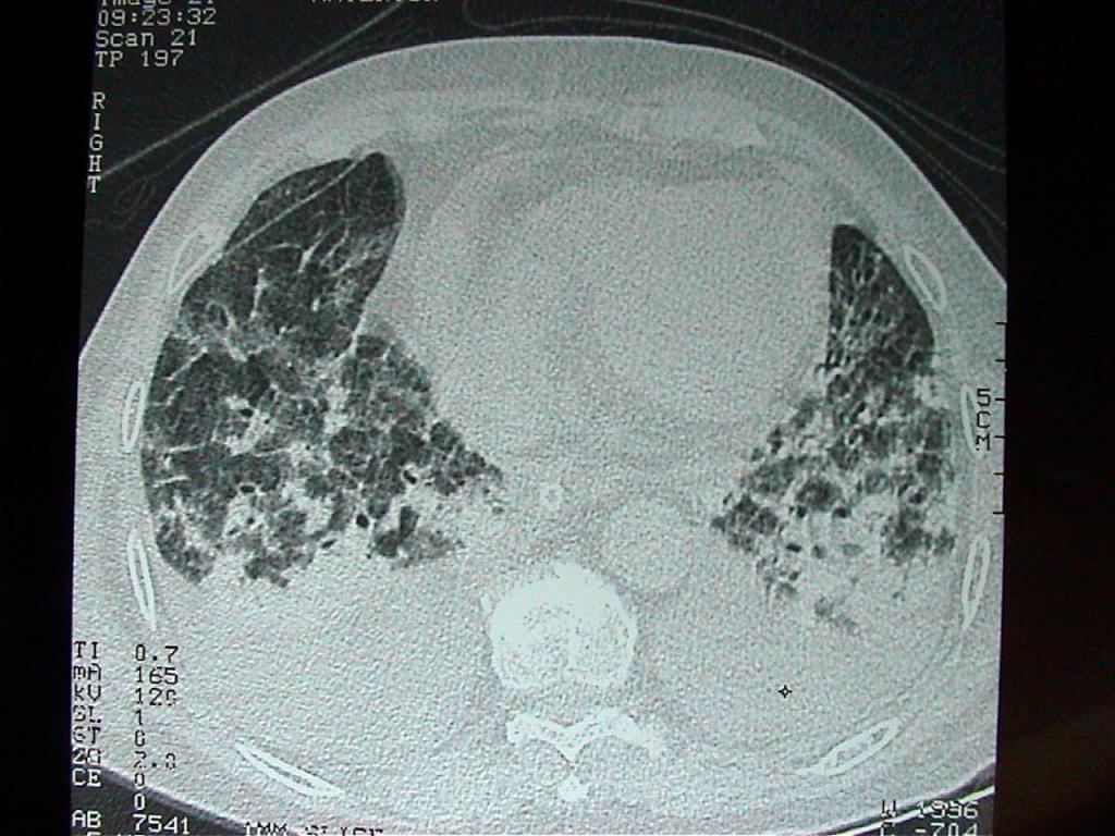 20011105 ct 4 desktop resolution