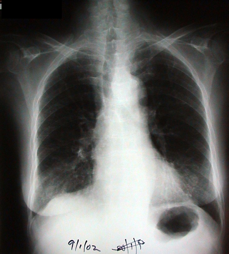 20020109 cxr desktop resolution