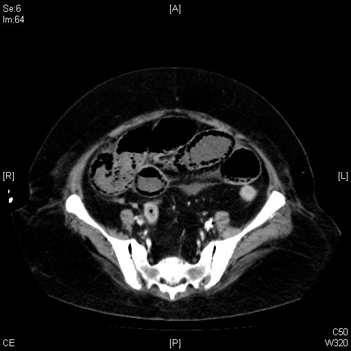 ct 2