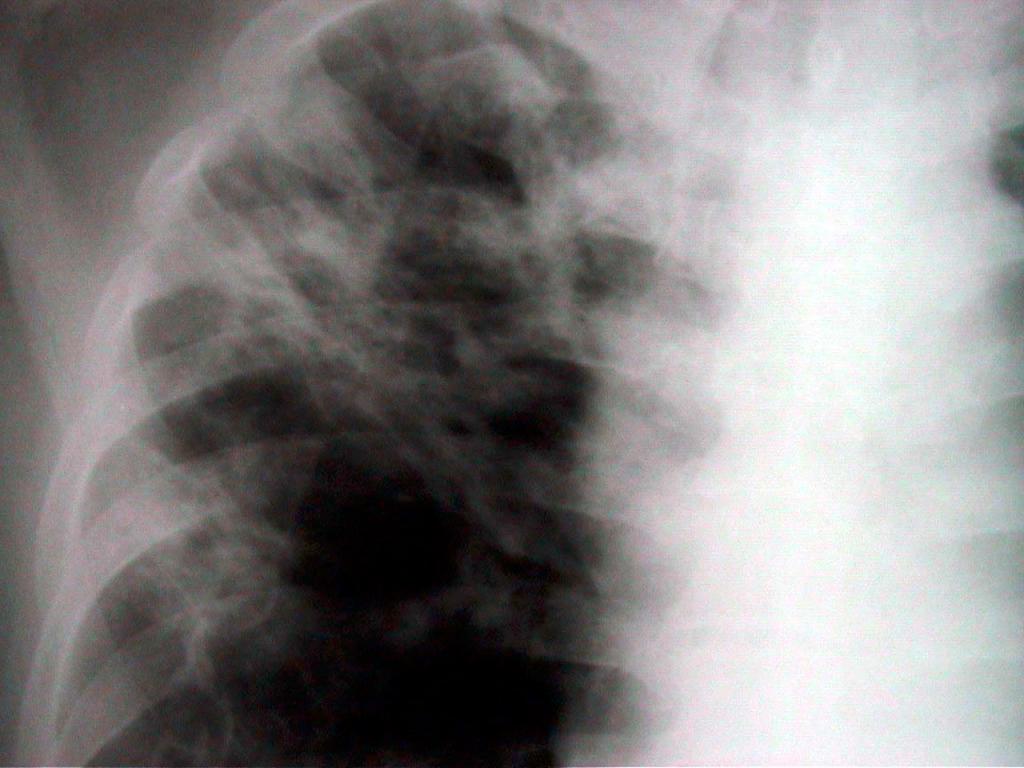 cxr 2 desktop resolution