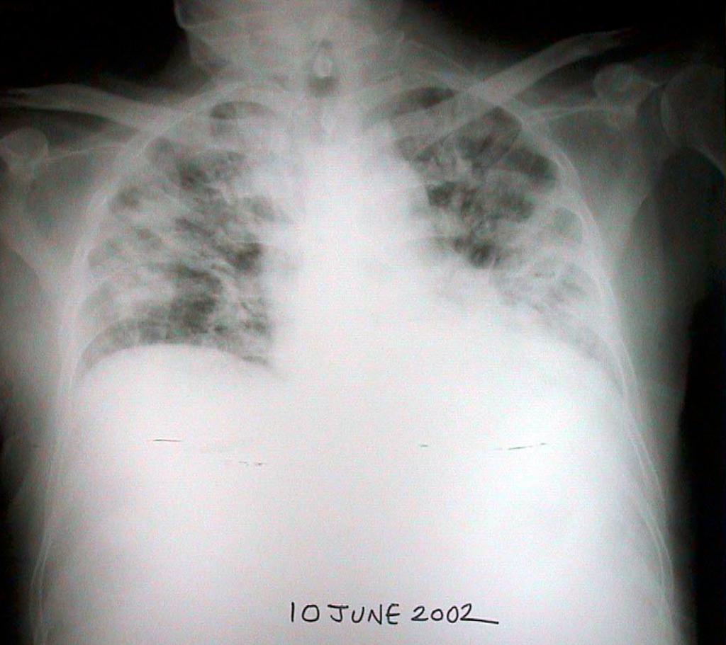 cxr 4 desktop resolution