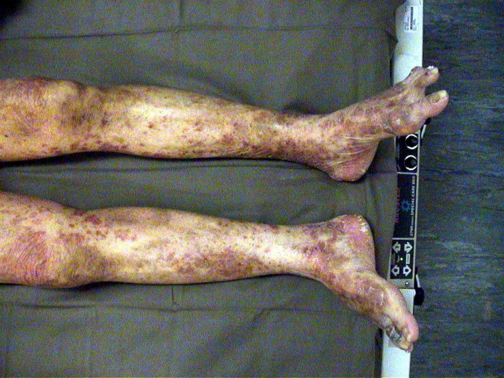 lower limb 1 desktop resolution