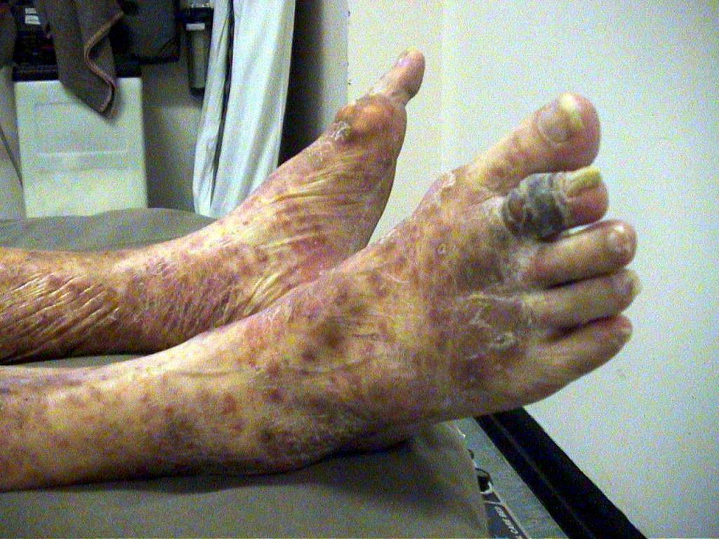 lower limb 2 desktop resolution