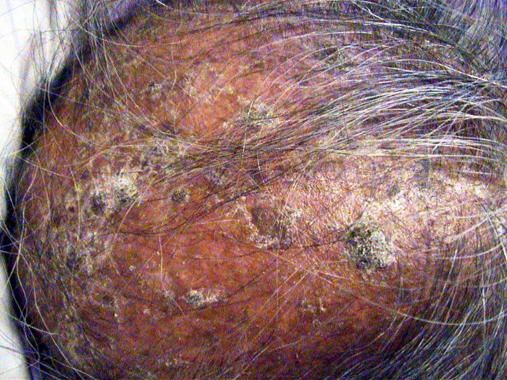 scalp desktop resolution