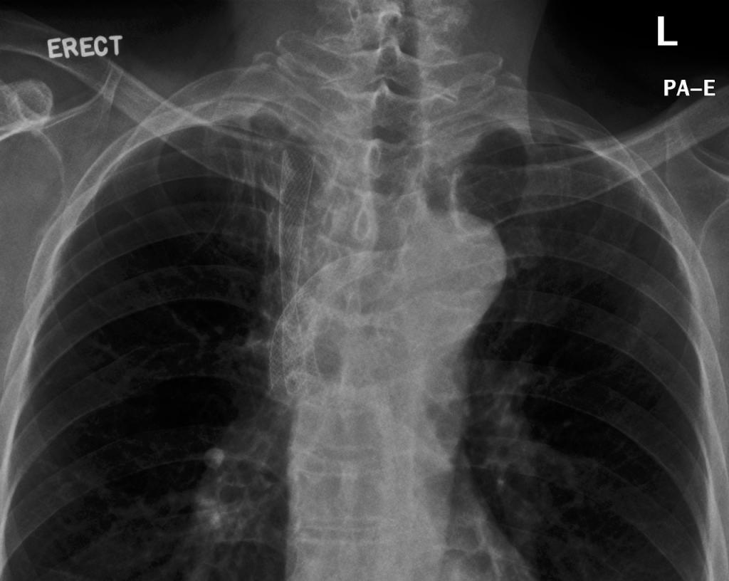 2008.12.22 cxr desktop resolution