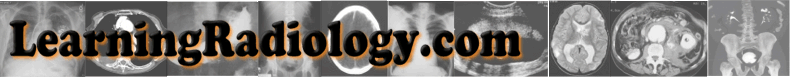 bannerwithhighlight