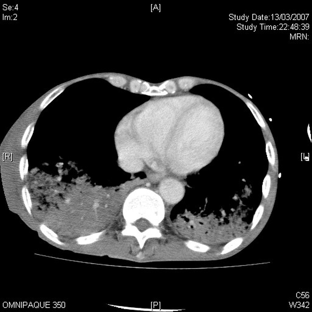chest abd windown desktop resolution