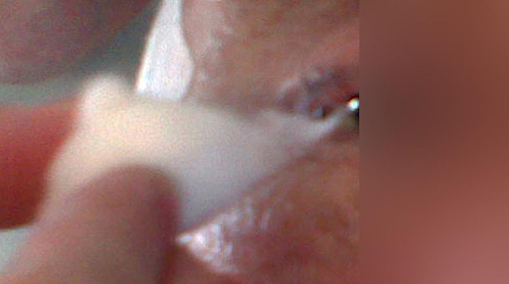 corneal reflex desktop resolution