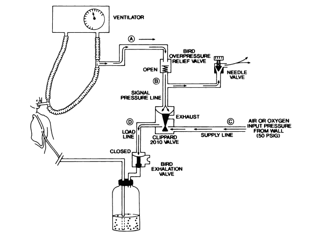 intermittent insp chest tube occlusion