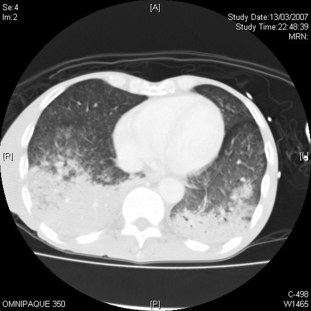 lung window desktop resolution