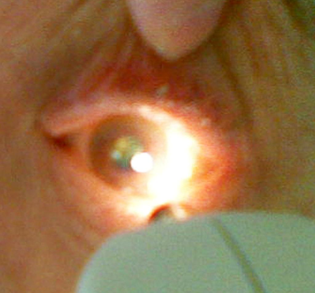 pupil response desktop resolution