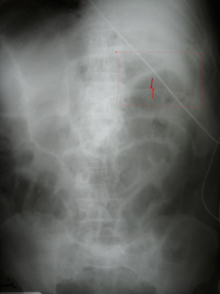 ans 1