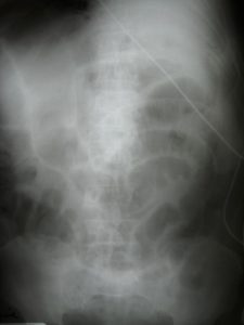 pp4