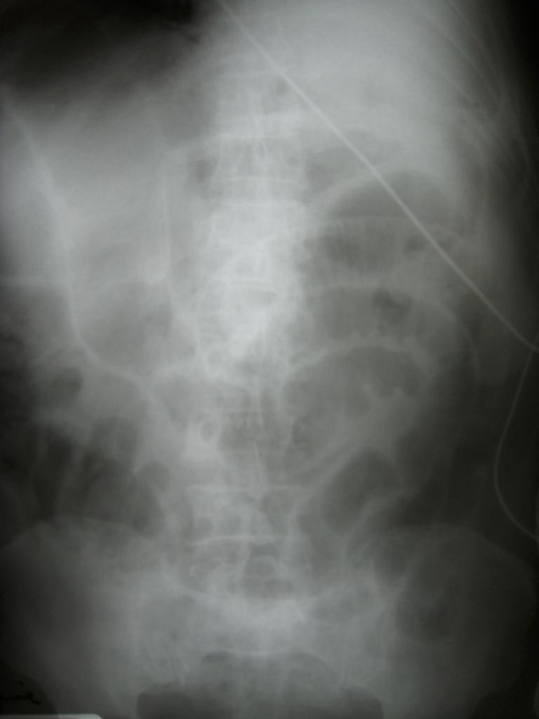 pp4