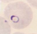 P. falciparum ring form